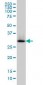 SCHAD / HADHSC Antibody (clone 4B5)